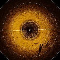 HUMMINBIRD MEGA 360 IMAGING – UNIVERSAL -Metsästys Verkäufe MEGA360 nakymakuva